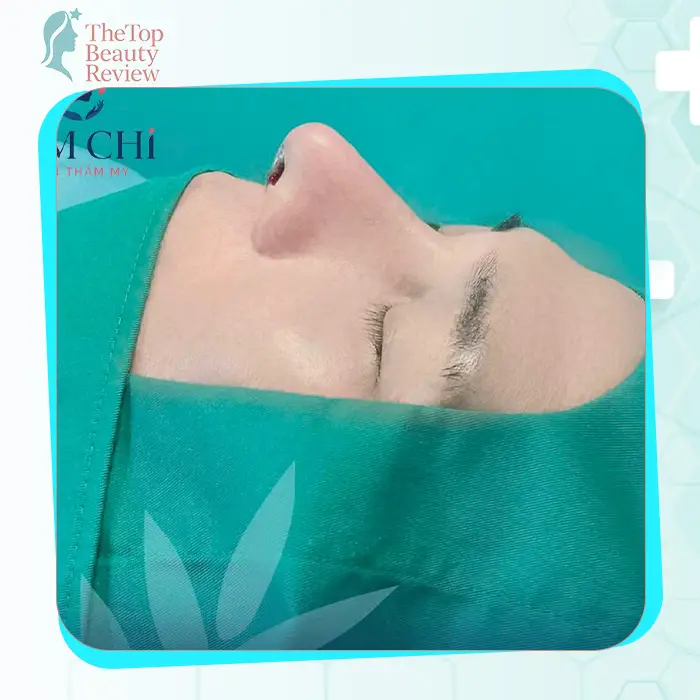 Khám phá Top 7+ Phòng khám phẫu thuật nâng mũi uy tín và an toàn nhất tại Bình Dương năm 2025