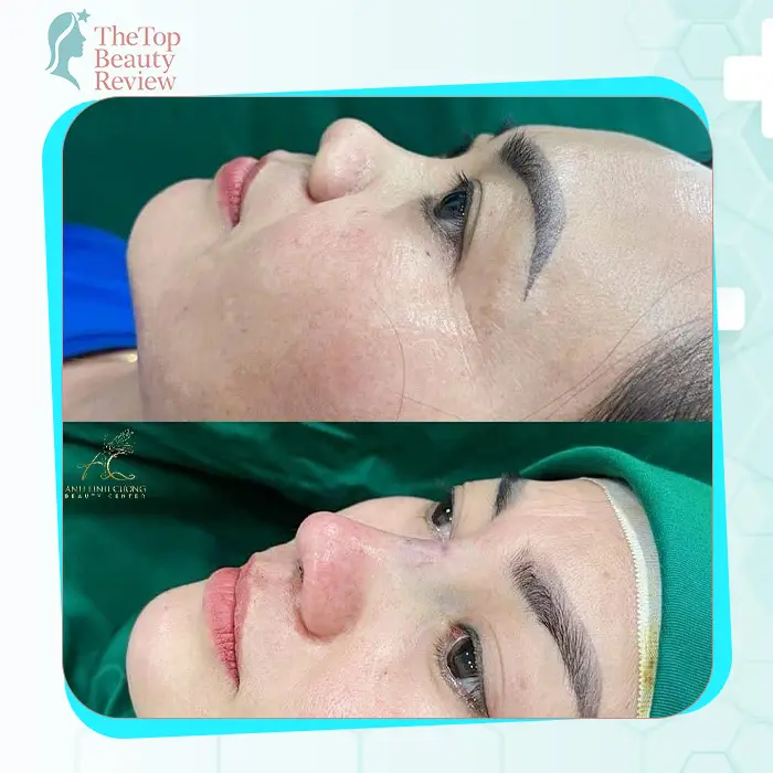 Khám Phá Top 7 Phòng Khám Nâng Mũi Hàng Đầu Tại Bà Rịa – Vũng Tàu