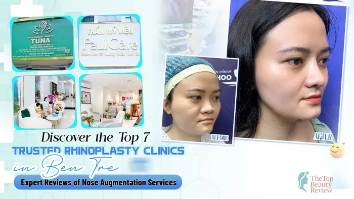 Discover the Top 7 Trusted Rhinoplasty Clinics in Ben Tre – Expert Reviews of Nose Augmentation Services