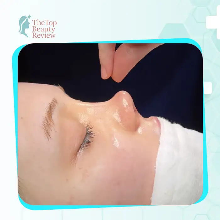 Rhinoplasty in Lai Chau: 7 Clinics Known for Proven Results & Fair Costs