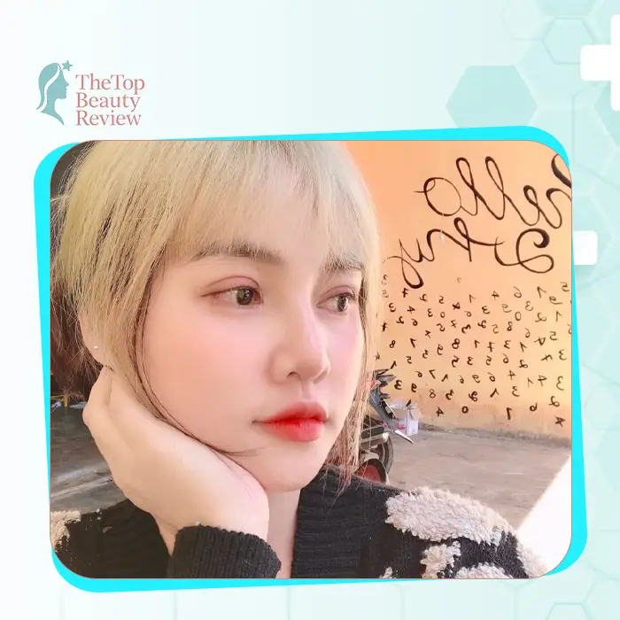 Discover the Top 7 Leading Rhinoplasty in Quang Binh: Reliable & Professional