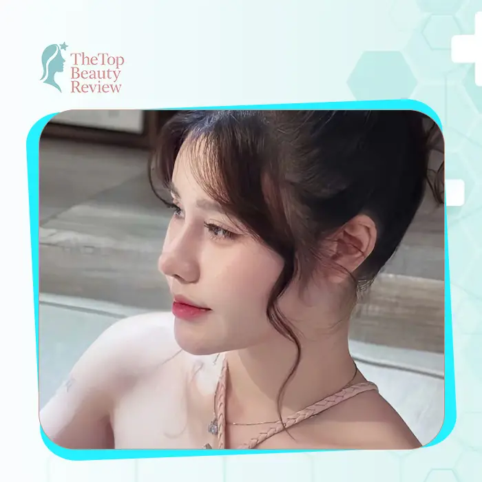 Discover the Top 7 Rhinoplasty in Thanh Hoa Trusted by Clients