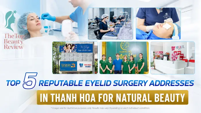 Top 6 Reputable Eyelid Surgery Addresses in Thanh Hoa for Natural Beauty