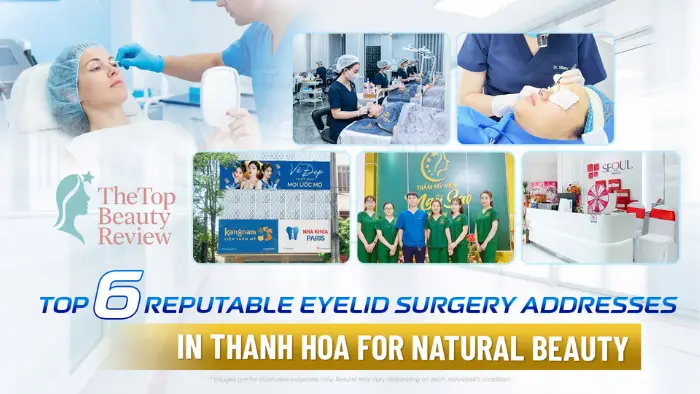 Top 6 Reputable Eyelid Surgery Addresses in Thanh Hoa for Natural Beauty