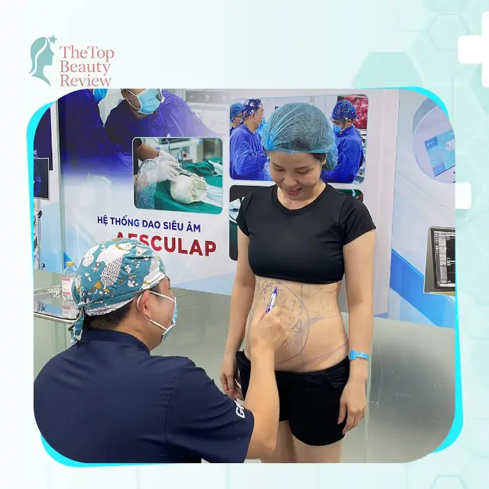 Best Liposuction in Vietnam – Top 6 Reputable Clinics in 2026