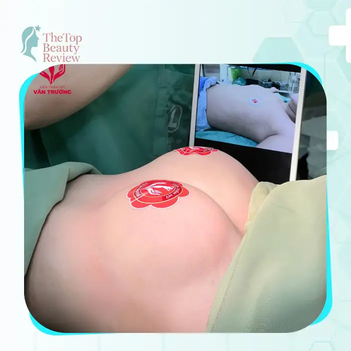 Top 5 Trusted Breast Augmentation Clinics in An Giang Worth Considering