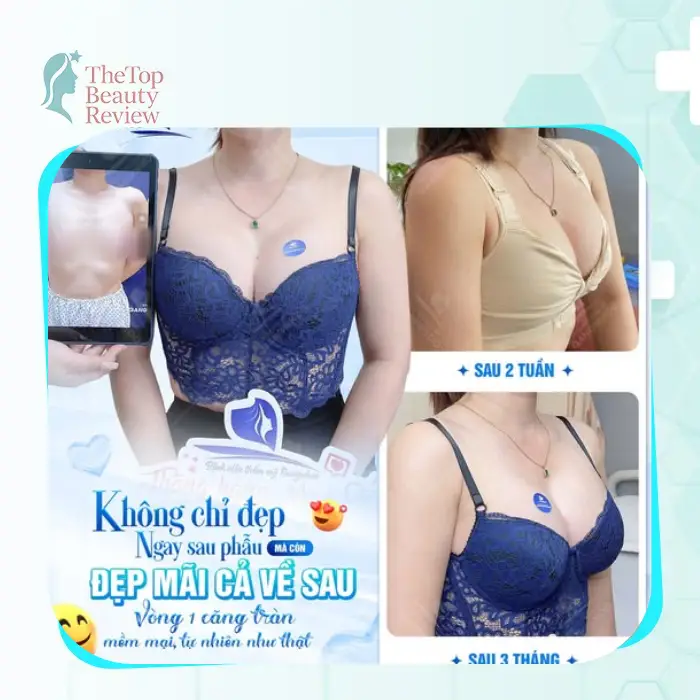 Top 5 Best Breast Augmentation Clinics in Ho Chi Minh City