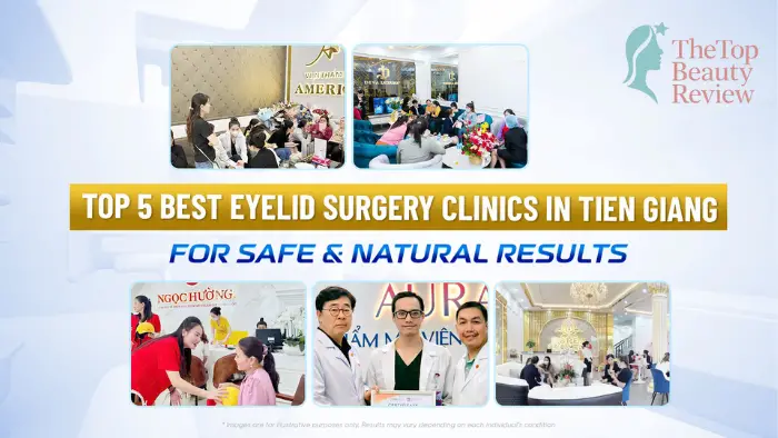 Top 5 Best Eyelid Surgery Clinics in Tien Giang for Safe & Natural Results