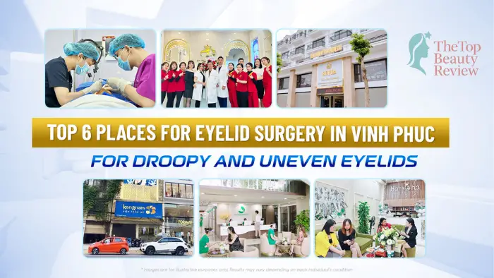 Top 6 places for eyelid surgery in Vinh Phuc for droopy and uneven eyelids