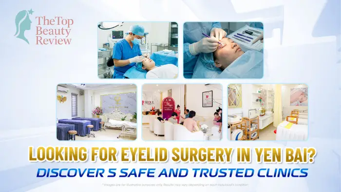 Looking for Eyelid Surgery in Yen Bai? Discover 5 Safe and Trusted Clinics