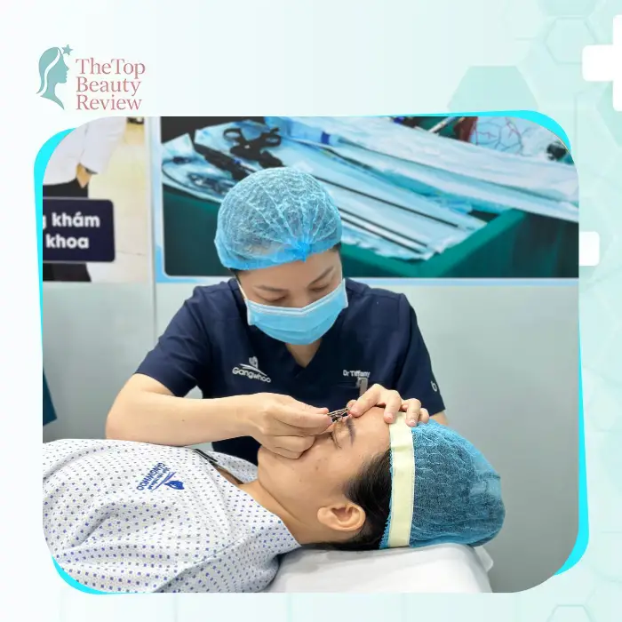 Eyelid Surgery in Tan Phu District – Top 4 Reputable Clinics with Natural-Looking Results