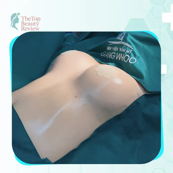 Top 6 Reputable Breast Augmentation Clinics in District 8, Ho Chi Minh City