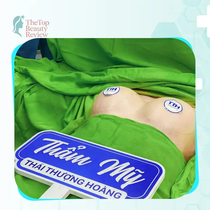 Top 4 Beauty Clinics for Breast Augmentation in Nghe An