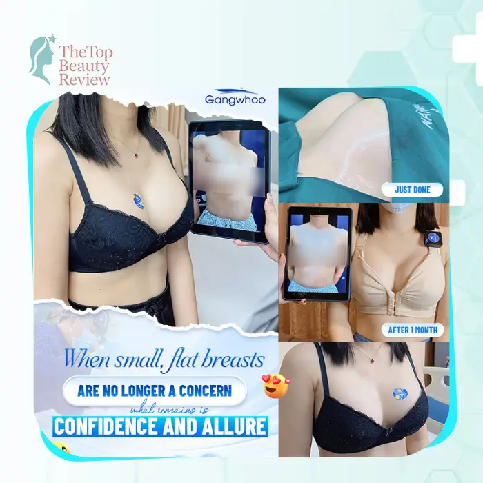 Where to Get Breast Augmentation in Phu Tho? 5 Addresses Many Women Are Interested In