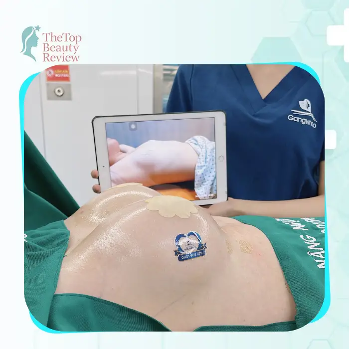 Breast Augmentation in Tien Giang: 6 Clinics Many Clients Explore Today