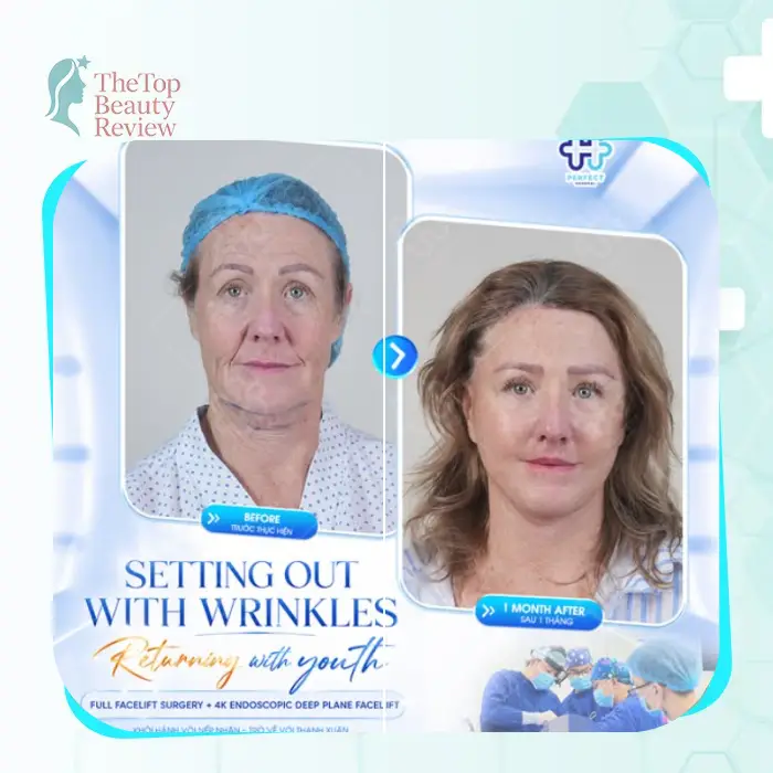 Discover the Top 5 Facelift Clinics in Ca Mau