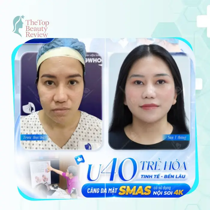 Suggested Top 5 Facelift Clinics in Dong Thap