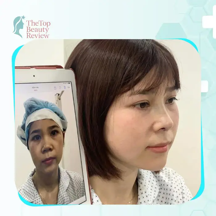 Discover the Top 5 Facelift Clinics for Residents of Cao Bang and Nearby Areas