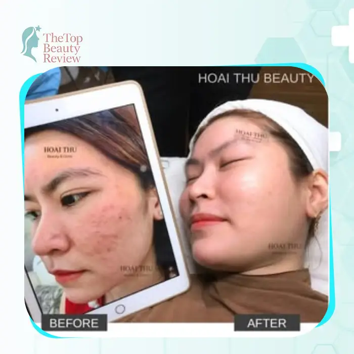 Facelift in Thai Nguyen 3 Skin Care and Facial Rejuvenation Clinics to Explore
