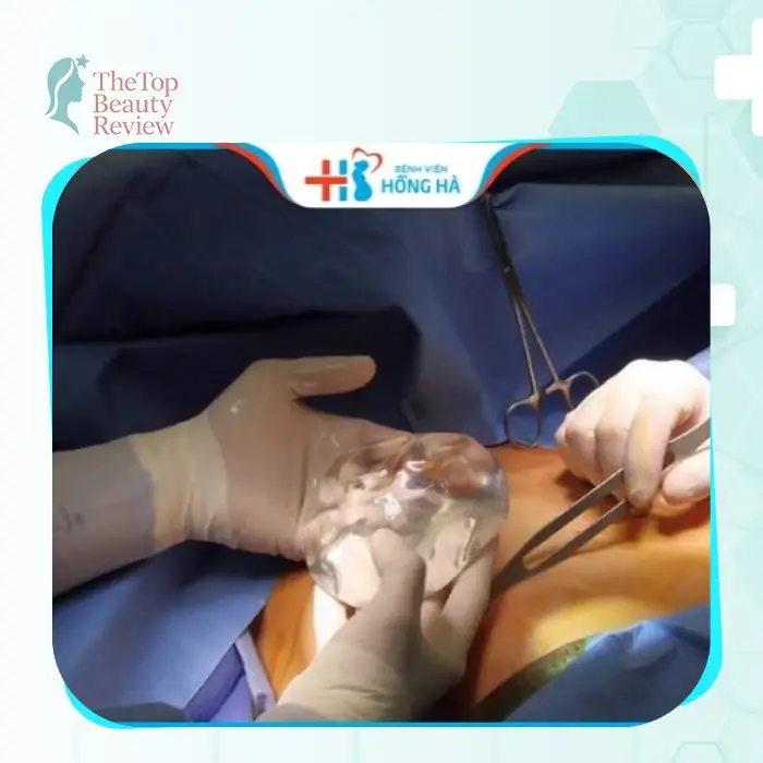 Buttock Augmentation in District 6 – 7 Nearby Facilities to Consider