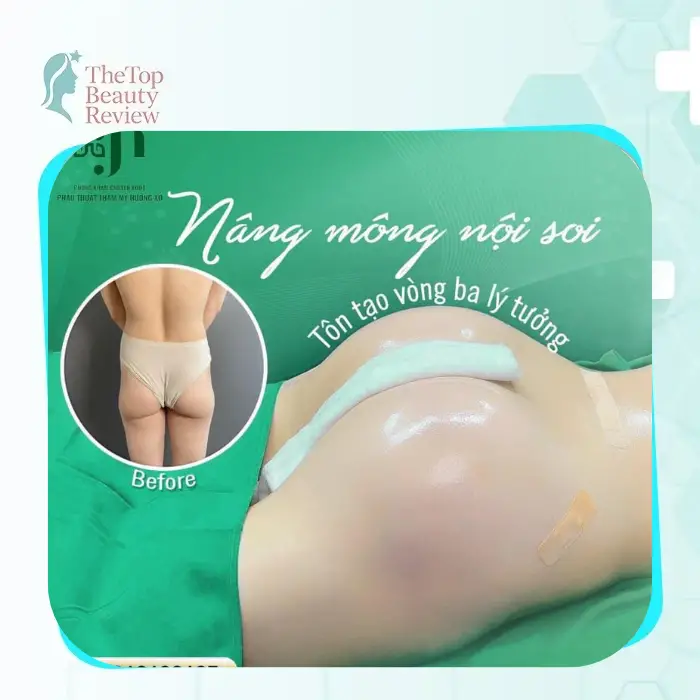 Buttock Augmentation in Nghe An – 4 Facilities to Consider