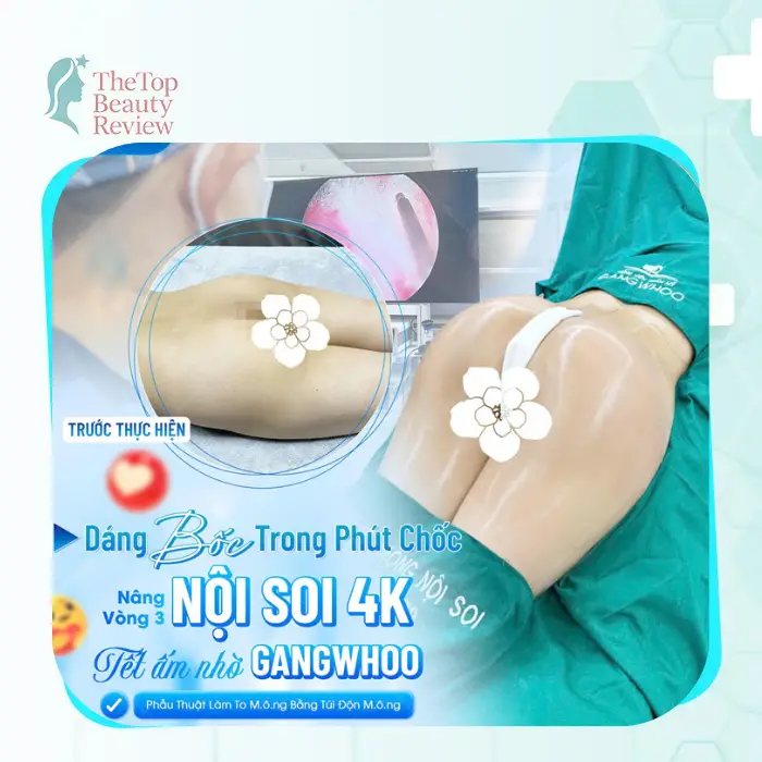 Buttock Augmentation Near Nam Dinh – 4 Facilities to Consider